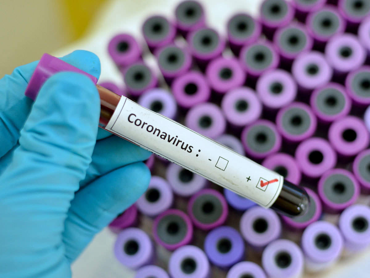 KESK: Koronavirüs Tehdidine Karşı Kaderlerine Terk Edilen Milyonların Çığlığına Kulak Verin!